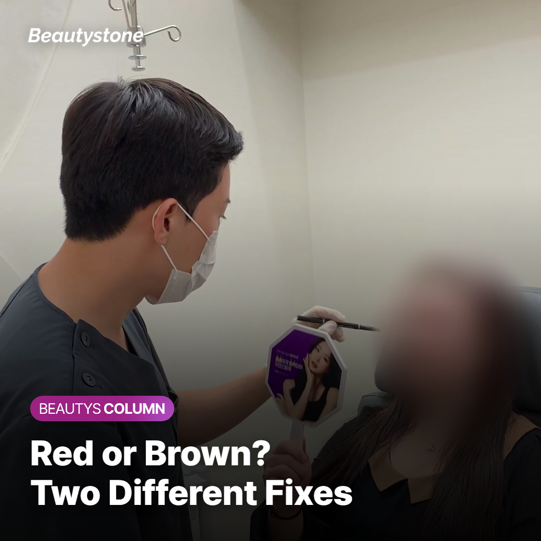 Red Marks vs. Brown Marks: PIE and PIH