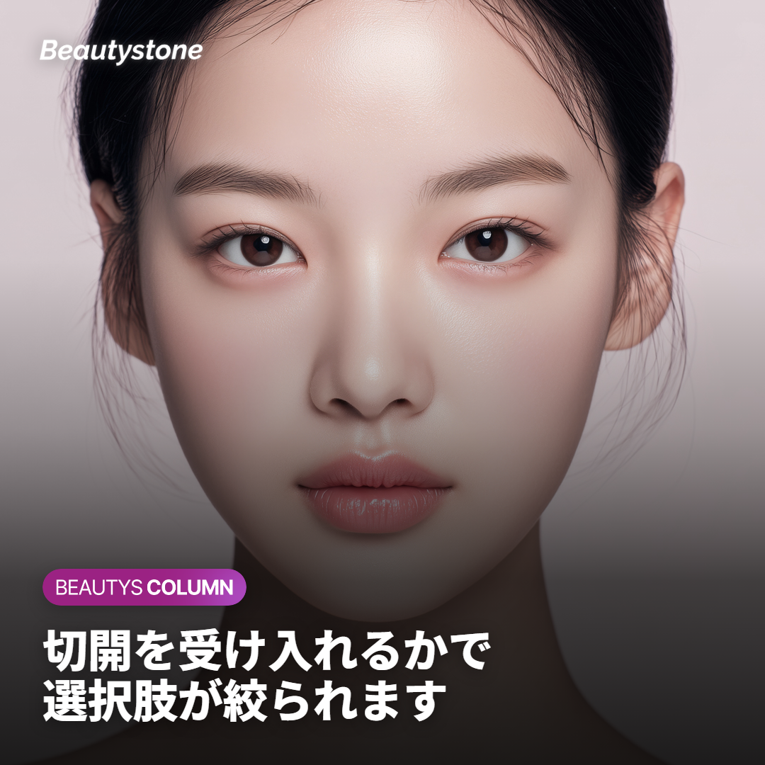 どちらを選ぶか、判断の目安