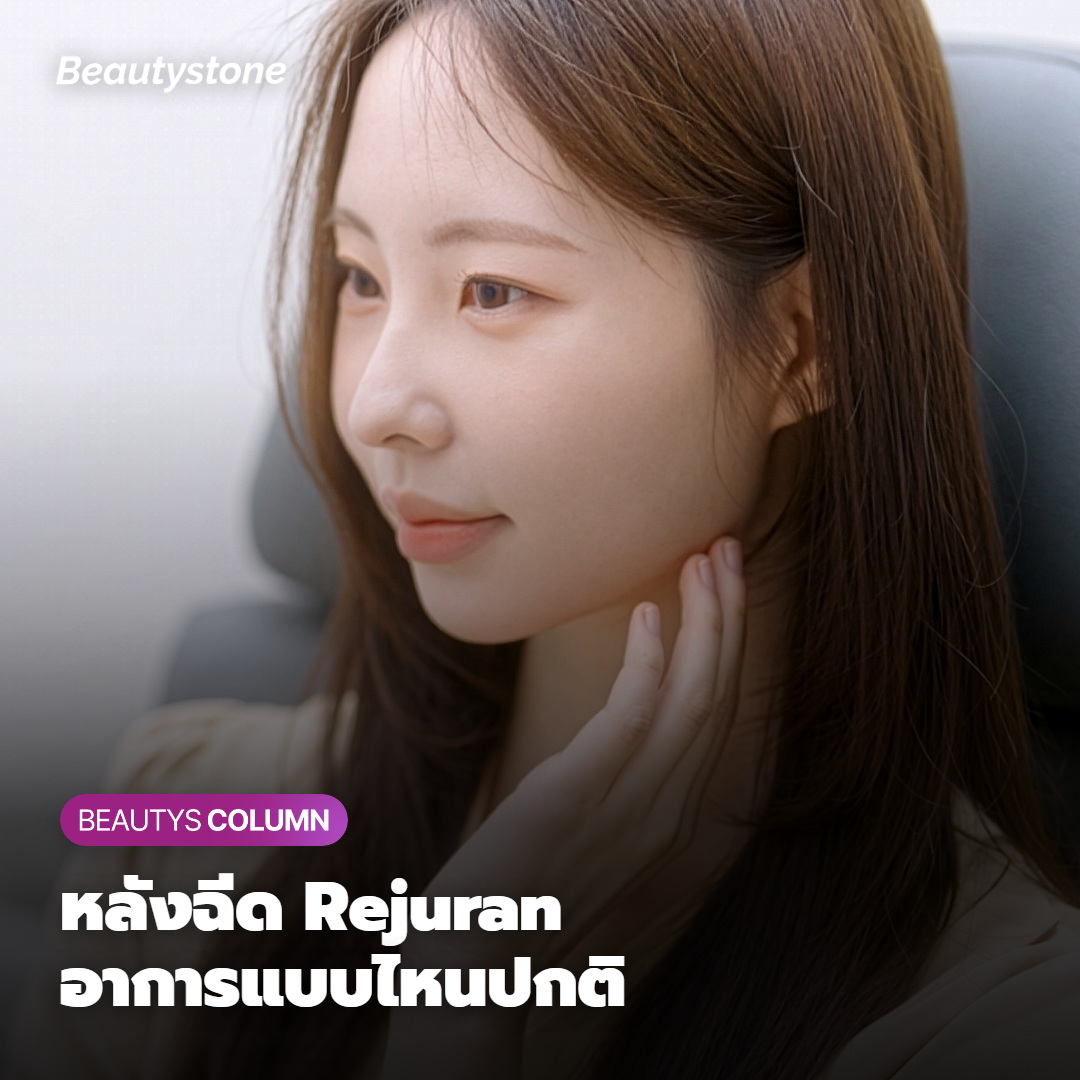 รอยช้ำ บวม และตุ่มแข็งหลังฉีด Rejuran แบบไหนคือเรื่องปกติ