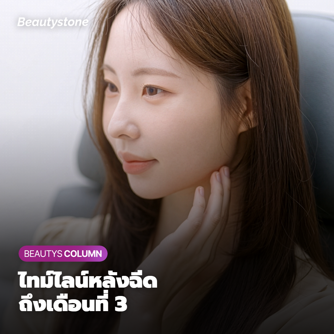 ไทม์ไลน์ตั้งแต่วันฉีดจนถึงเดือนที่ 3