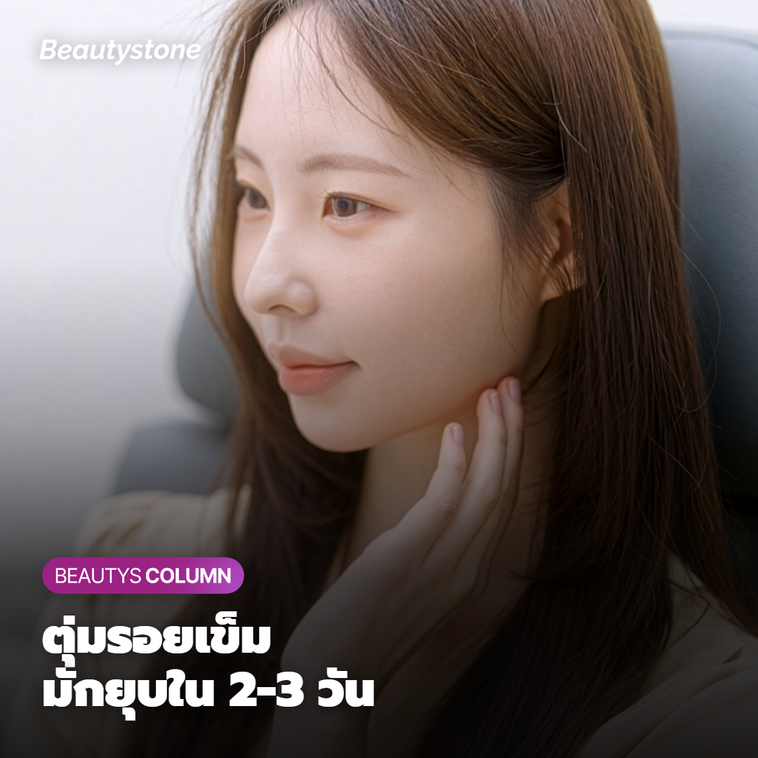 ผลข้างเคียงและข้อควรระวังหลังฉีด Rejuran