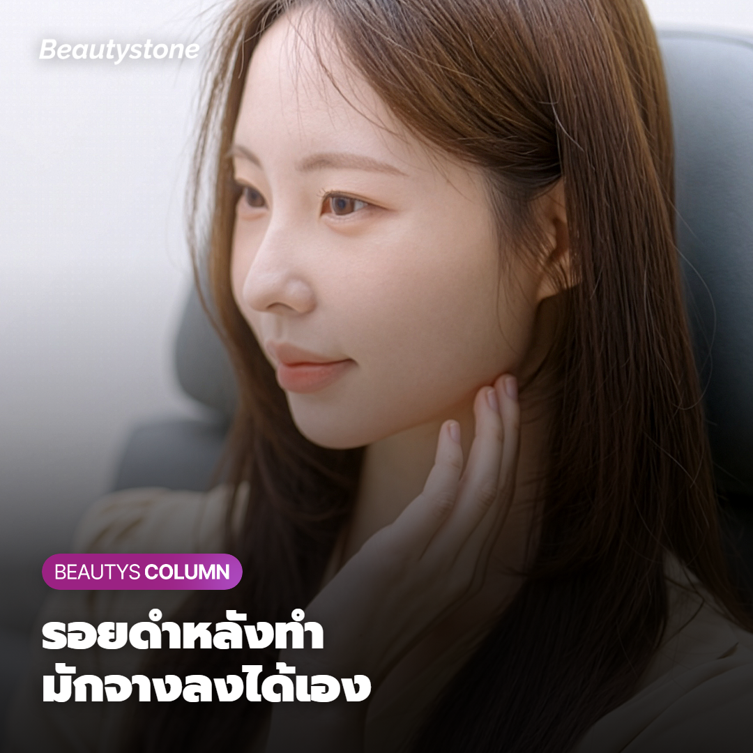 ผลข้างเคียงที่พบบ่อยและวิธีดูแล