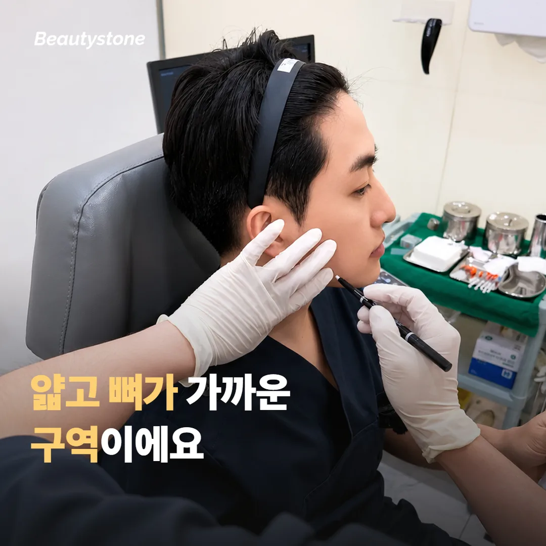 이마와 헤어라인이 다른 부위와 구분되는 지점