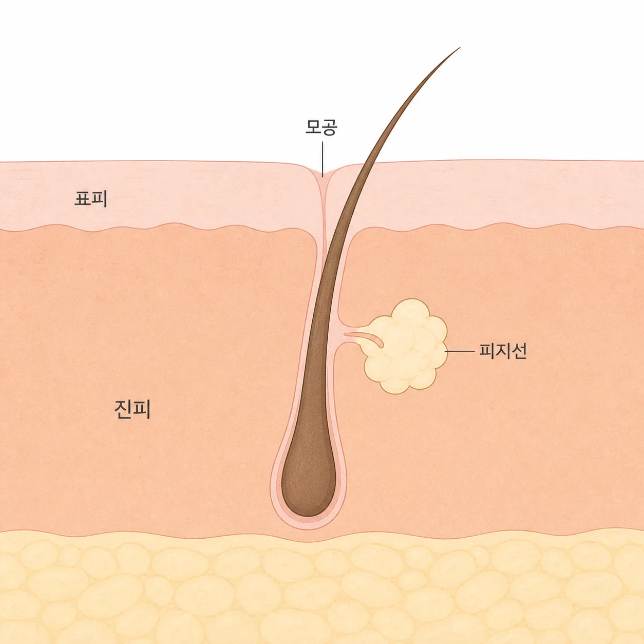 모공과 그 아래 붙어 있는 피지선