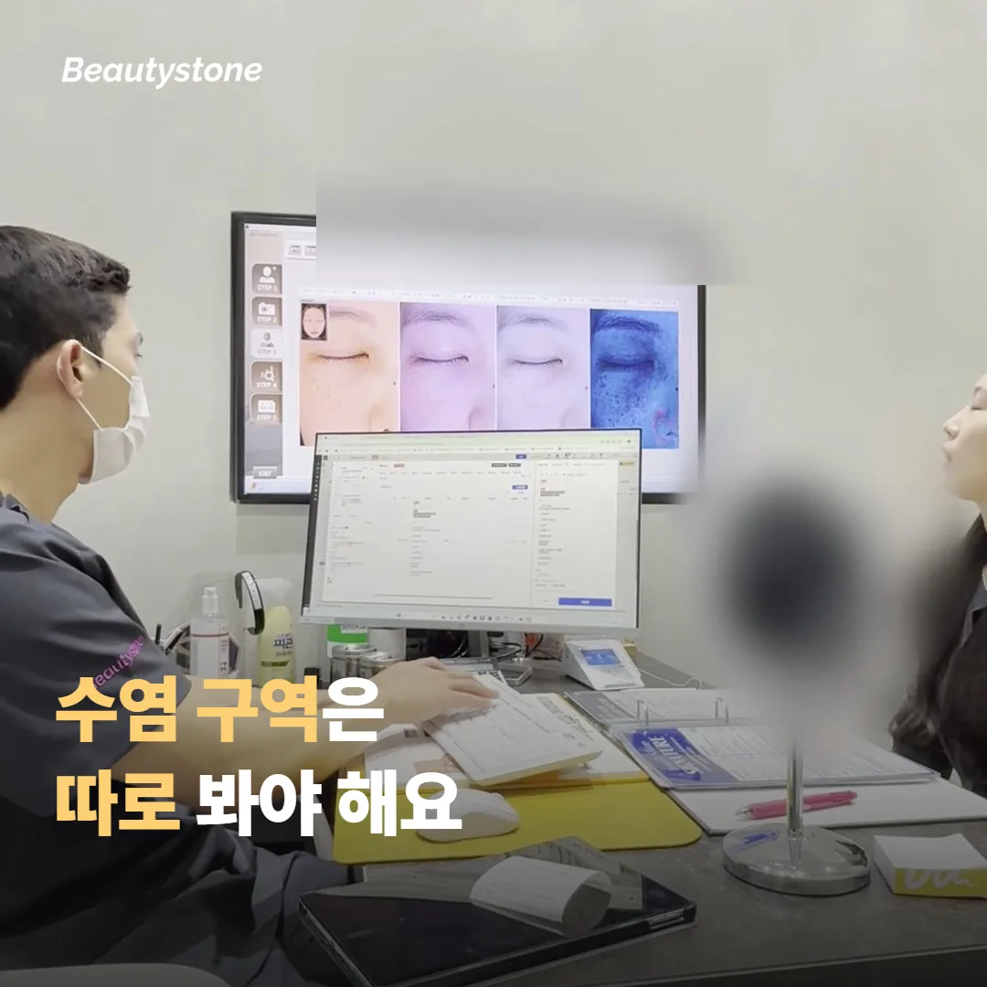 수염 부위에서 조심해야 할 점