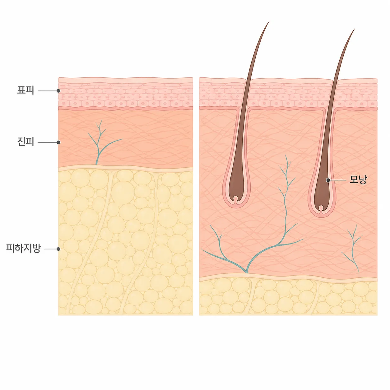 층 두께가 달라지면 열이 닿아야 하는 거리도 달라져요