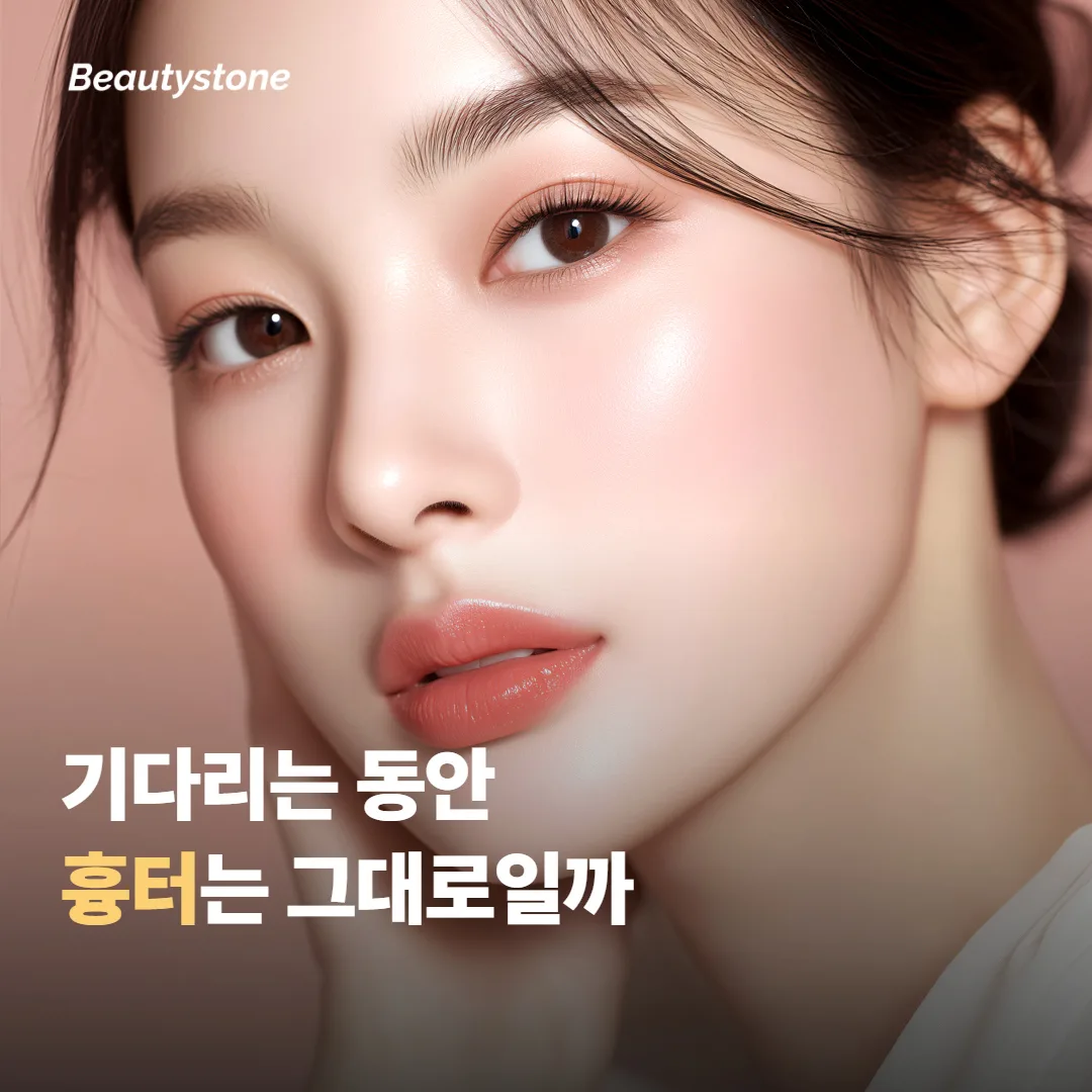 기다리는 동안 흉터는 그대로 있나요