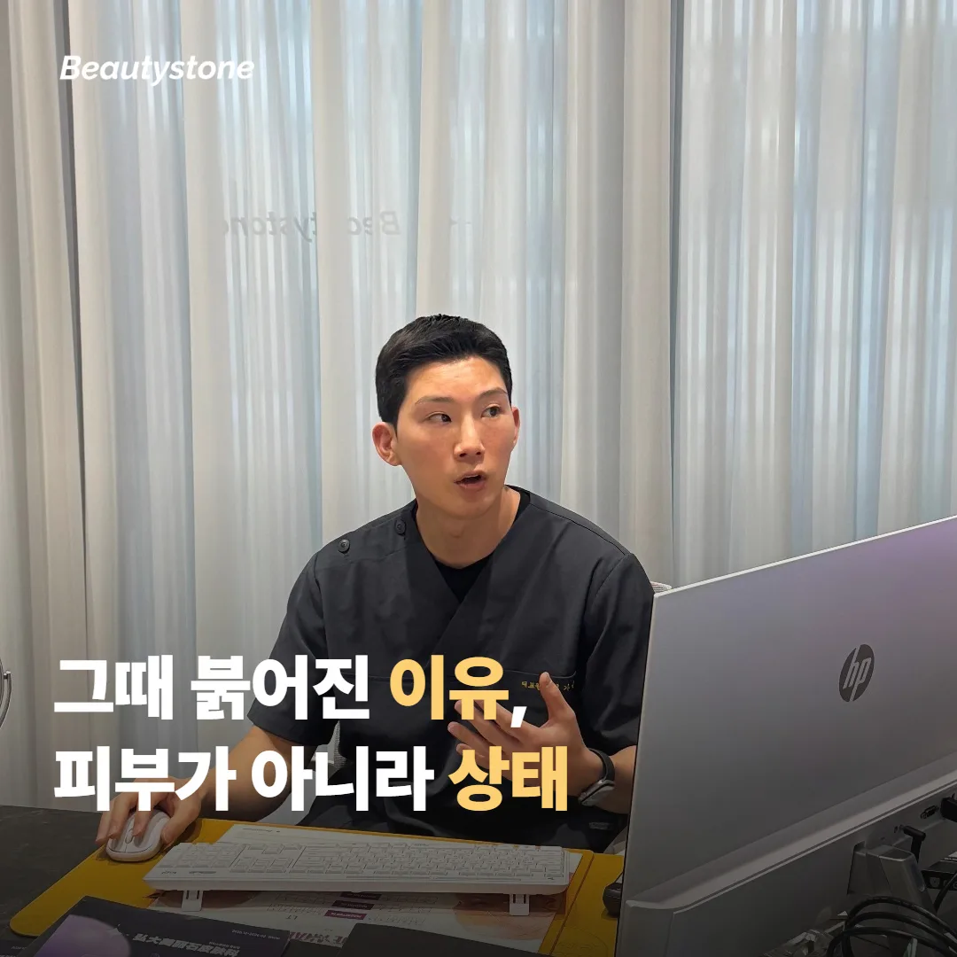 한 번 붉어진 적이 있으면 레이저 토닝은 포기해야 할까요?