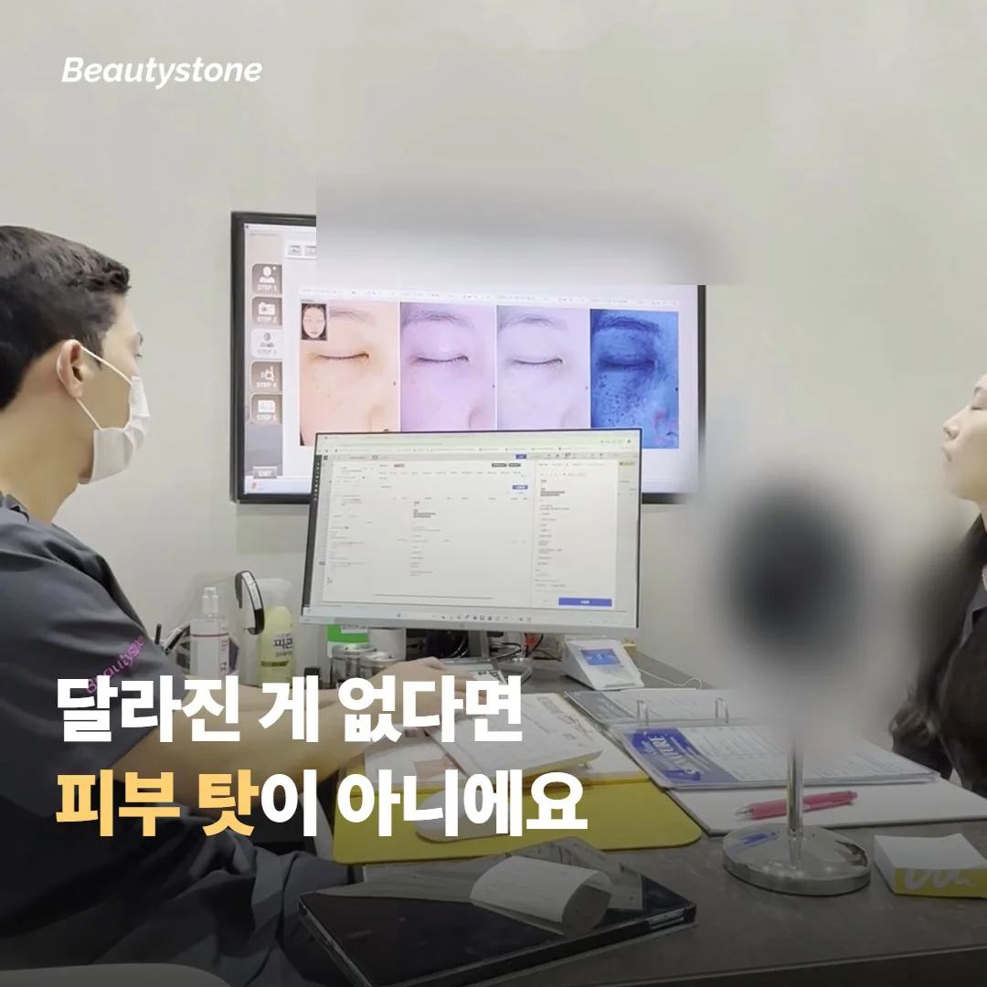 리프팅을 받았는데 왜 달라진 게 없다고 느꼈을까요?