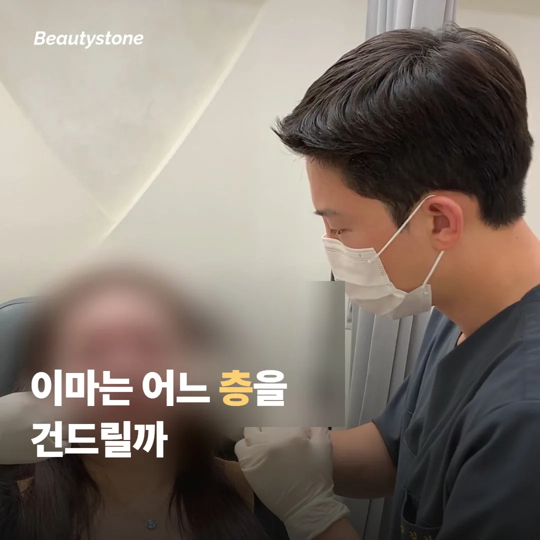 넓어 보이는 이마, 소프웨이브는 어느 층을 건드리나요