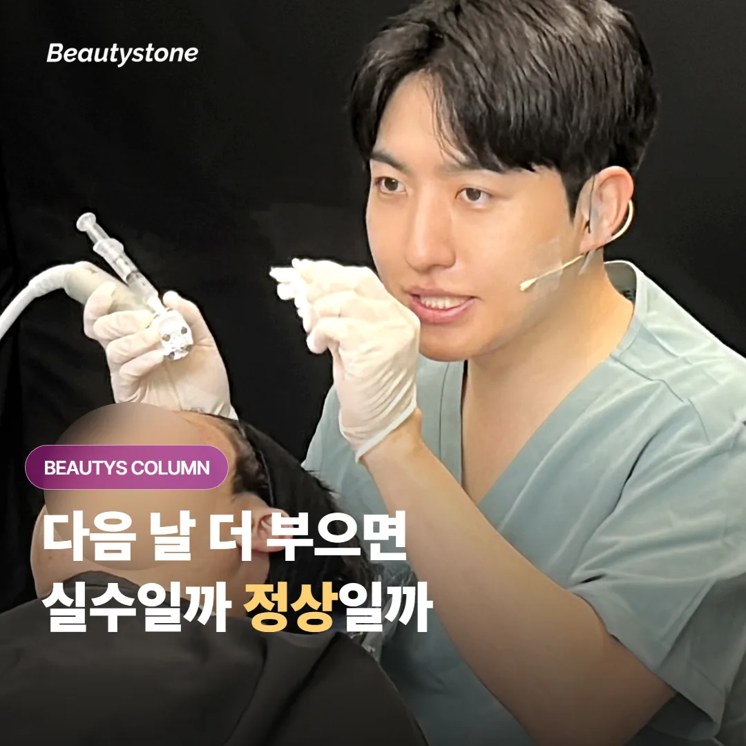 올리지오엑스 붓기, 다음 날 더 부었다면 실수일까 정상일까요