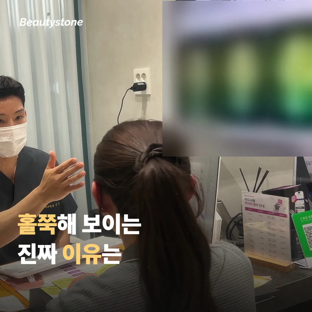 볼이 홀쭉해졌다는 후기는 어디서 나온 걸까요