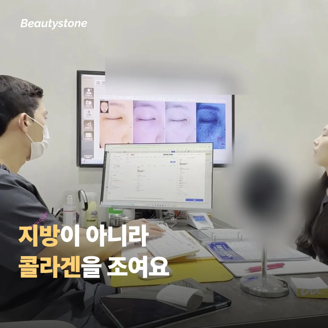 써마지의 열은 지방을 건드리나요, 콜라겐을 건드리나요
