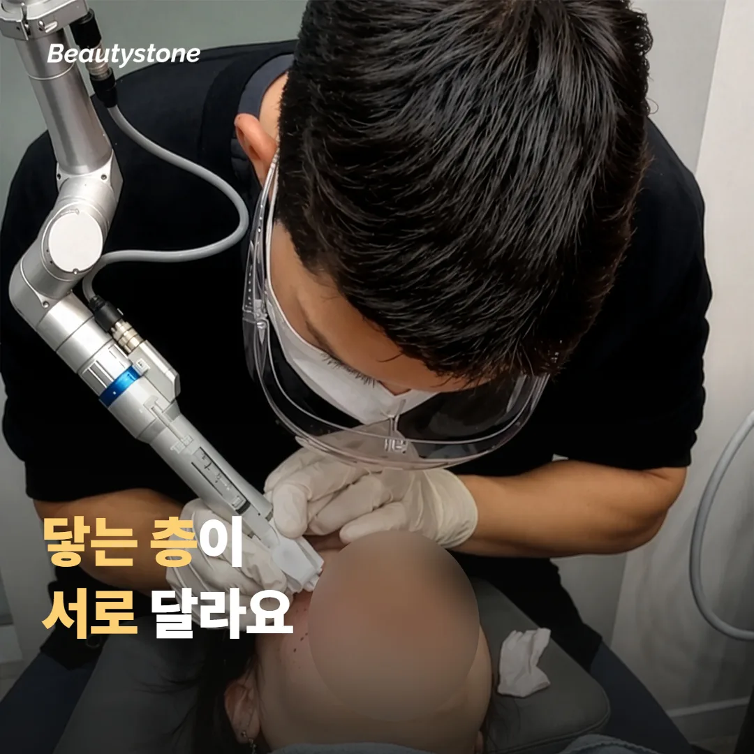 실 리프팅과 울쎄라 프라임은 작용하는 층이 달라요
