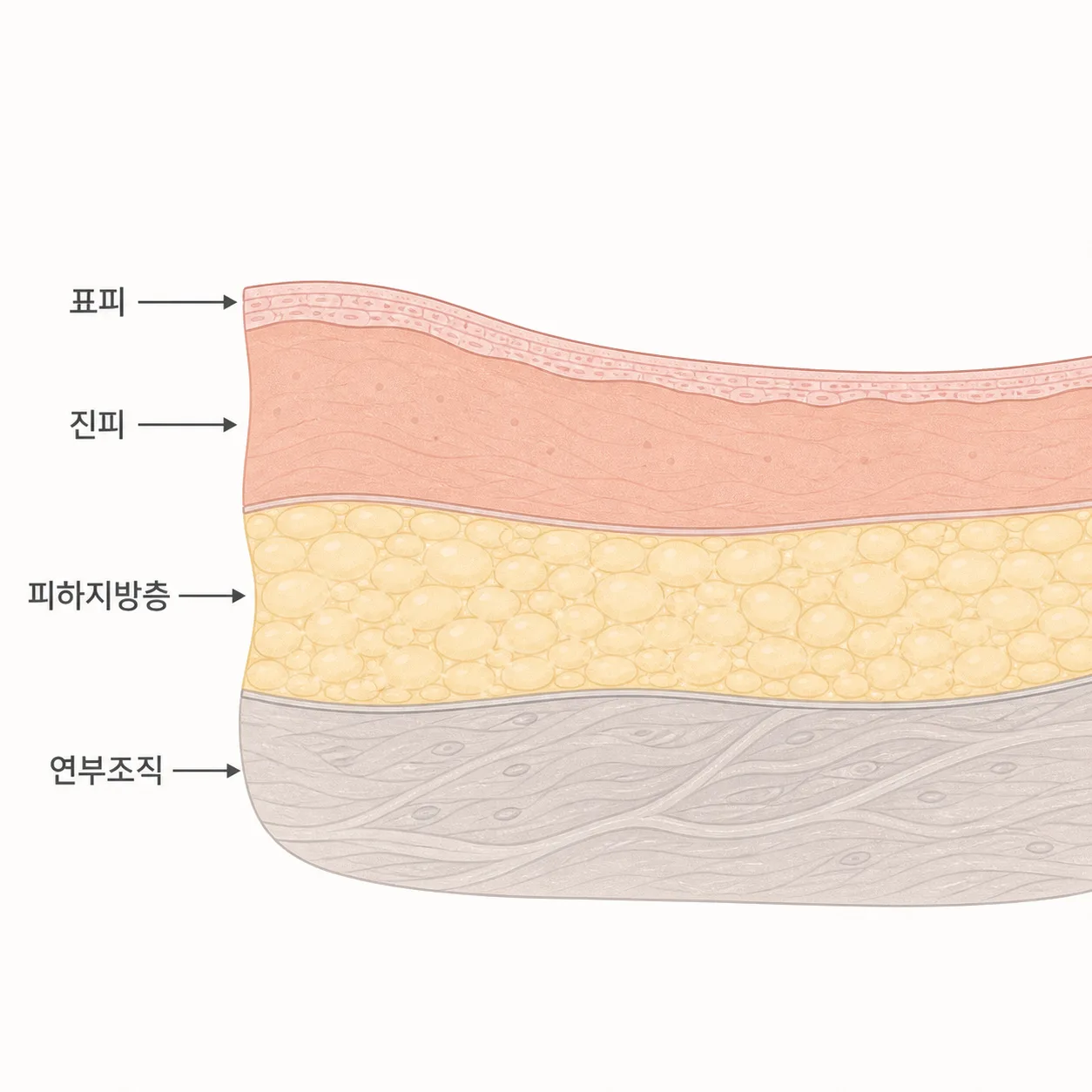 이중턱 부위의 피부층과 피하지방층 — 에너지가 닿는 층
