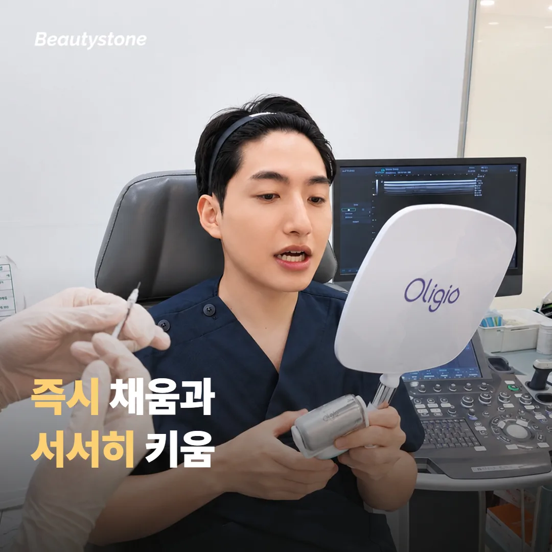즉시 채우는 쪽과 서서히 키우는 쪽의 차이