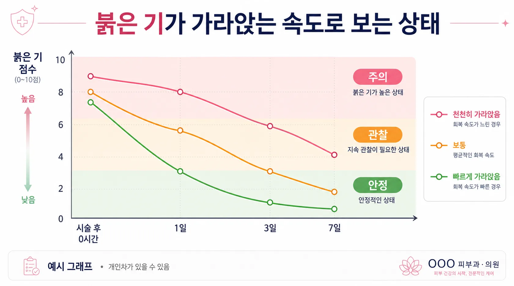 붉은 기가 가라앉는 속도로 보는 상태