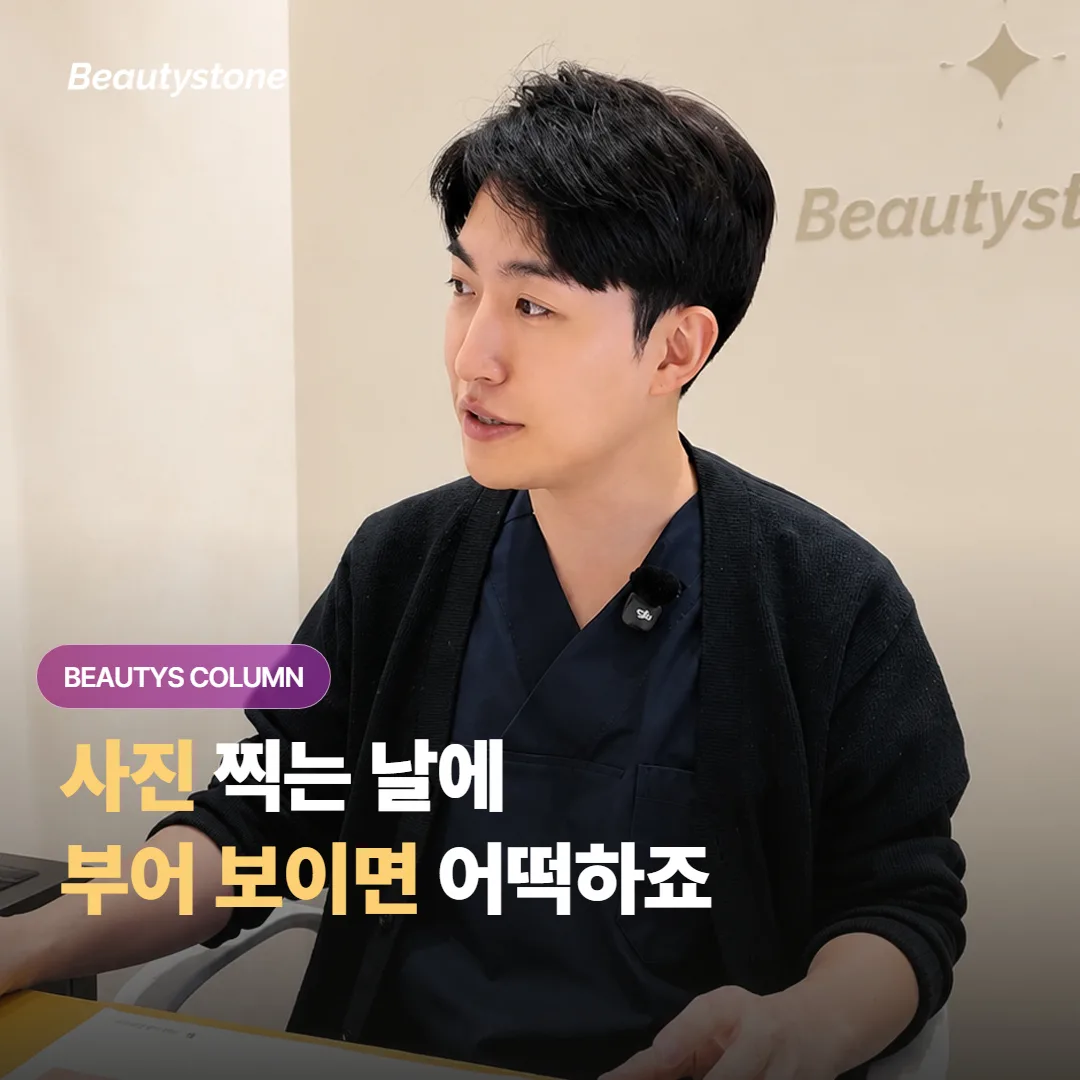 올리지오 엑스를 받고 나서 사진 찍는 날에 얼굴이 부어 보이면 어떡하나 걱정되나요?
