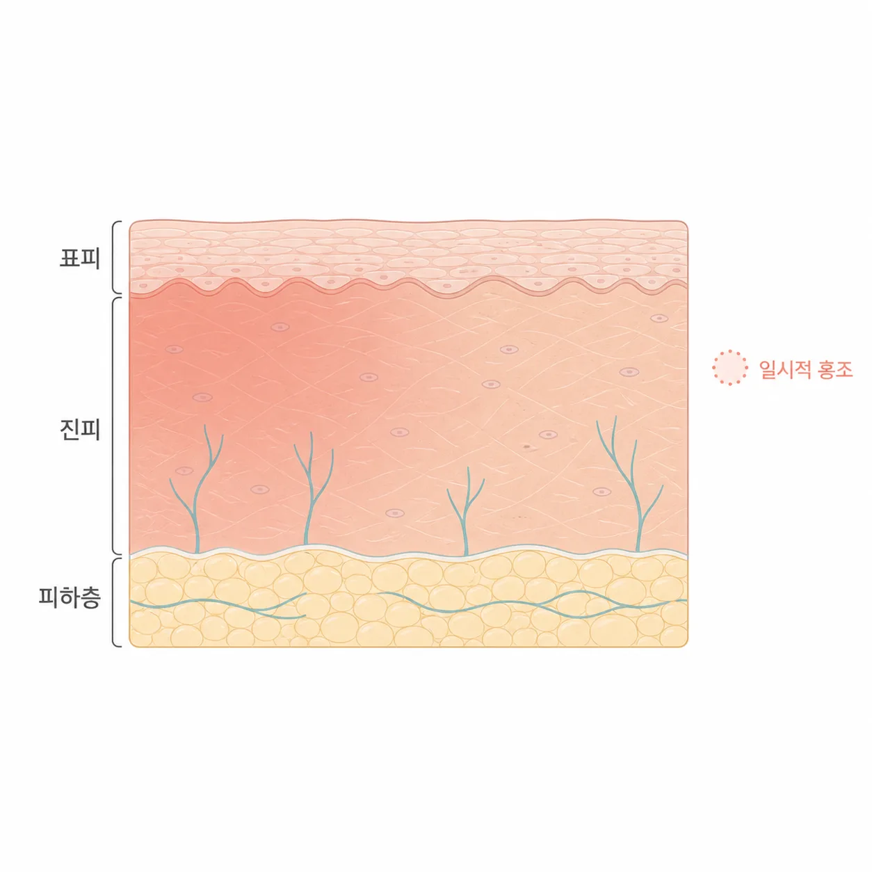 붉은 기가 올라왔다 가라앉는 피부 안쪽 흐름