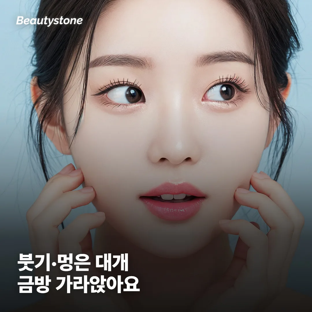 붓기나 멍, 통증은 어느 정도일까요?