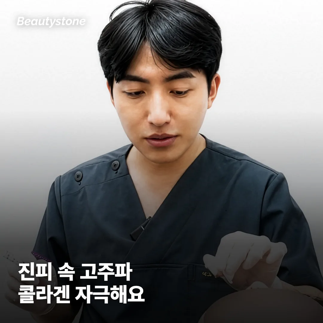 시크릿RF, 모공에 어떻게 작용하나요
