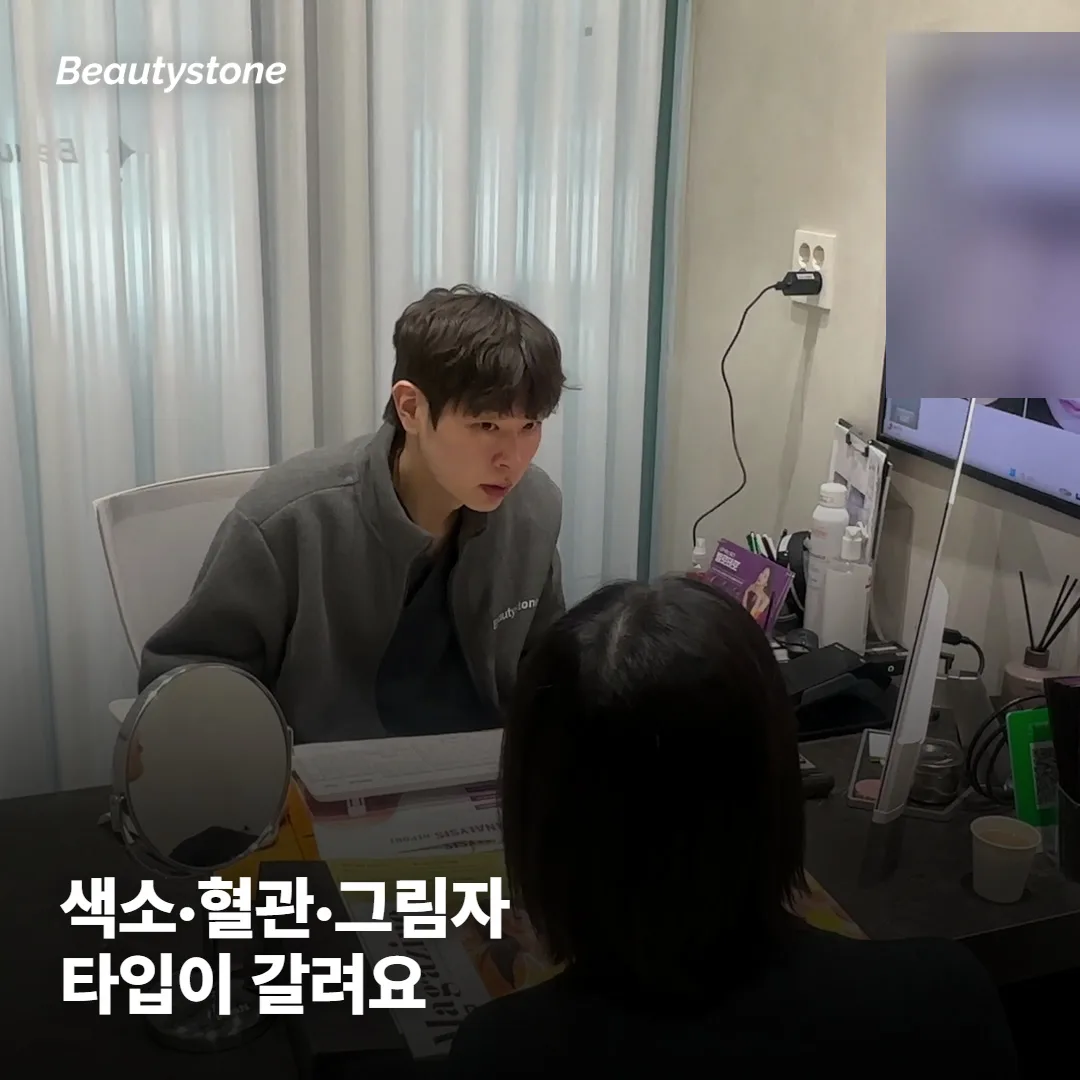 다크서클도 타입이 나뉜다고요?
