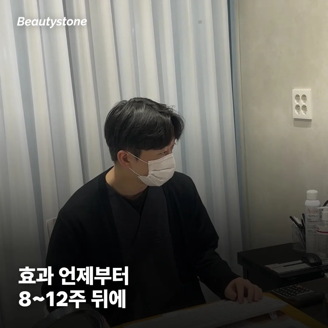 시크릿RF, 효과는 언제부터 보이나요?