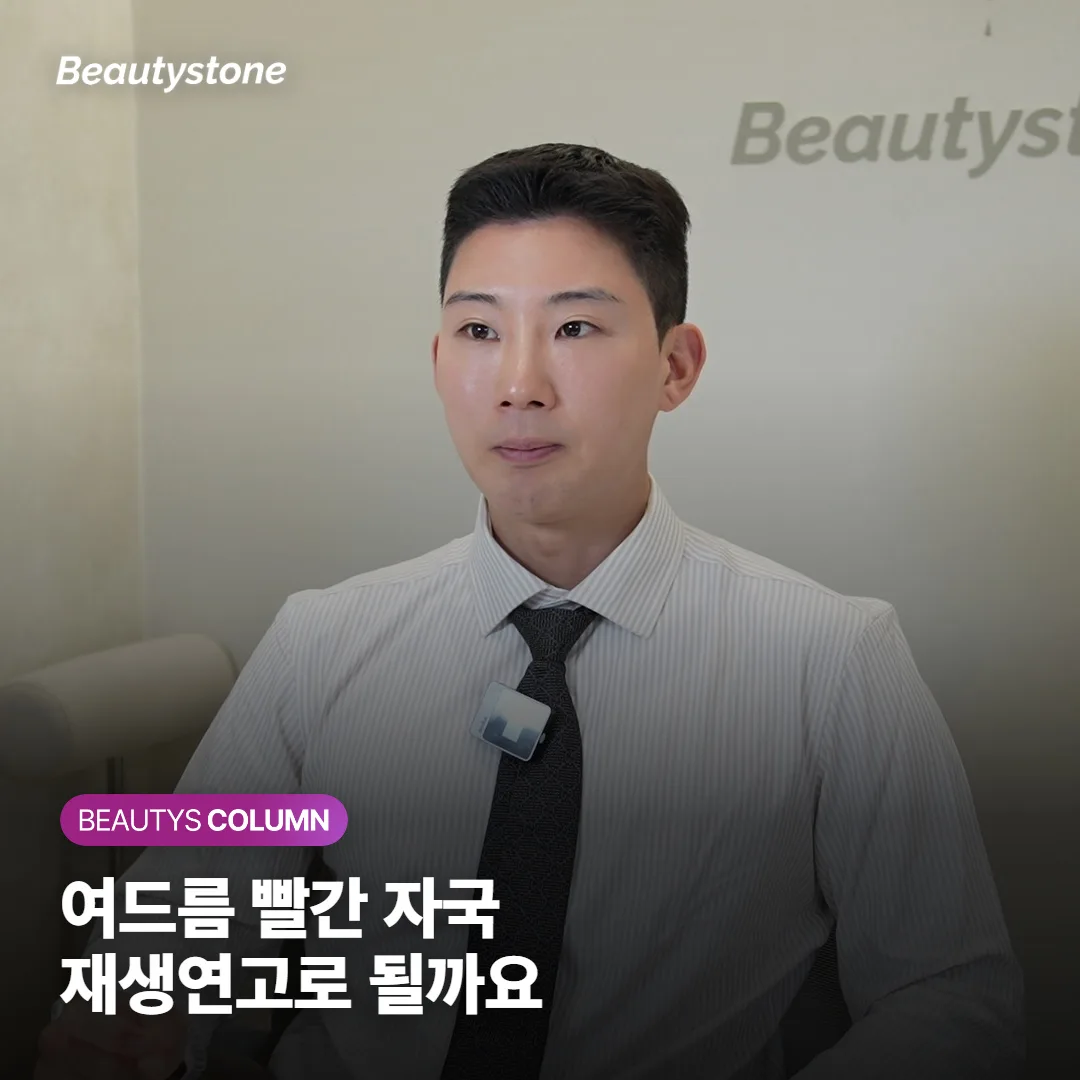 여드름 빨간 자국·갈색 자국, 재생연고로 옅어지는 경우와 시술이 필요한 경우를 구분해요
