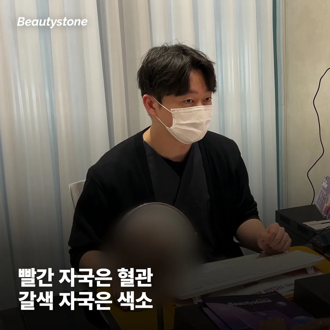 여드름 빨간 자국과 갈색 자국, 뭐가 다른가요?