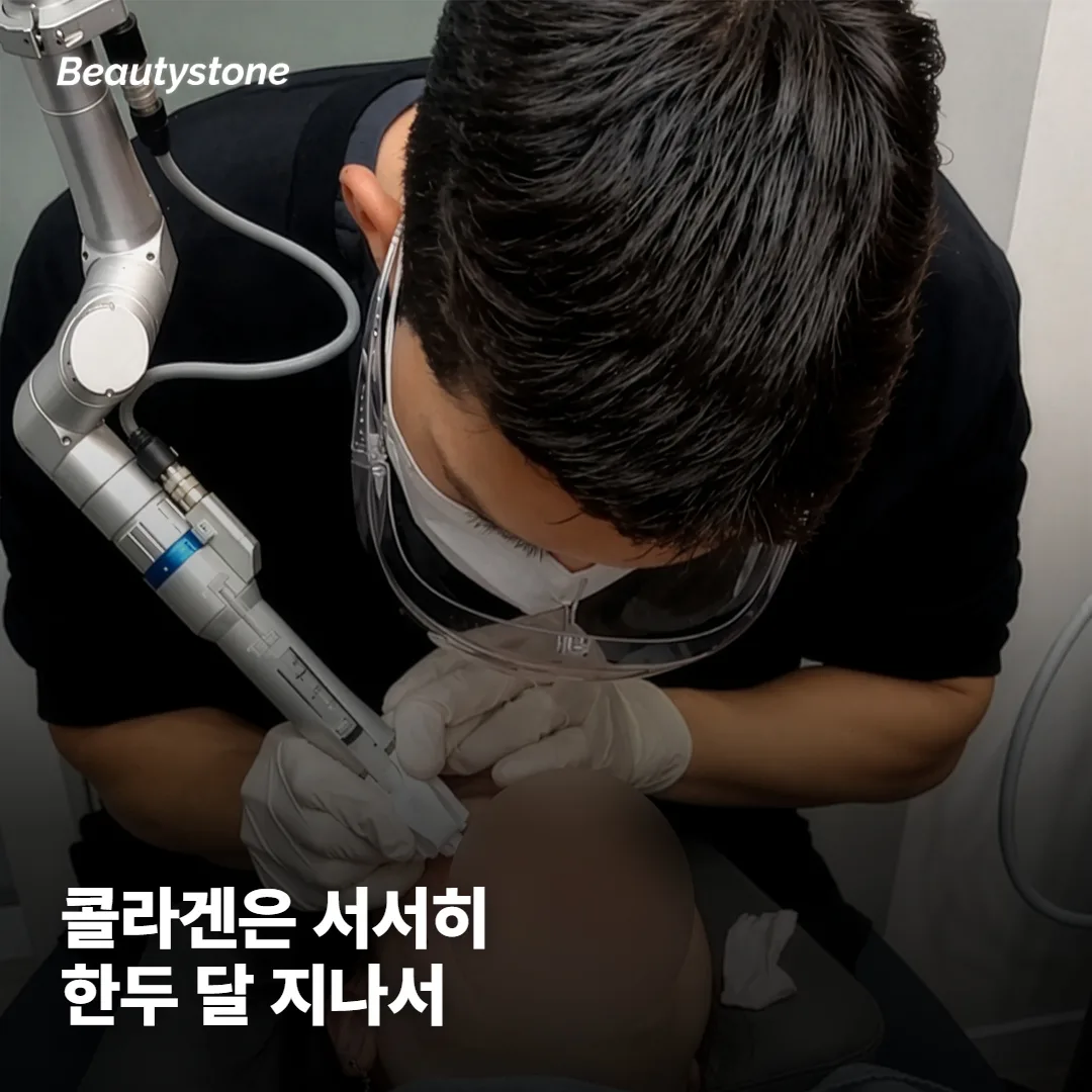 콜라겐 효과는 언제부터 보이나요?