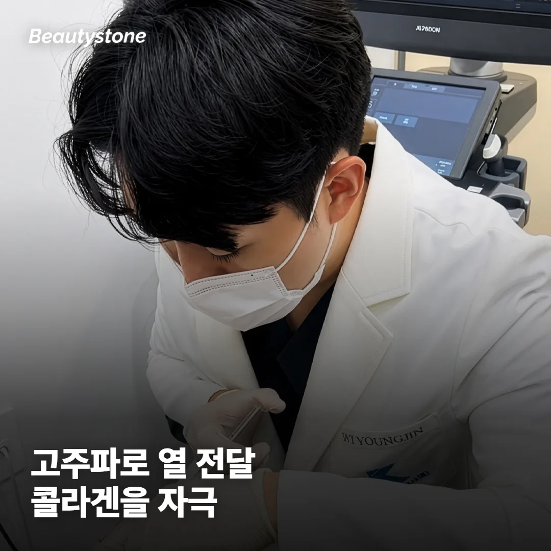 써마지는 어떻게 피부를 조여주나요?