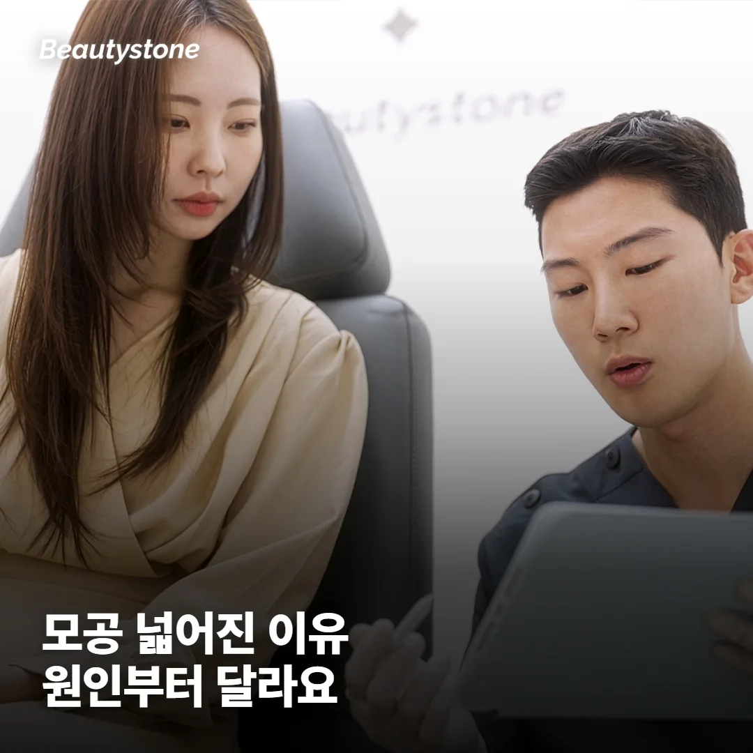모공이 넓어지는 이유부터 다른가요?