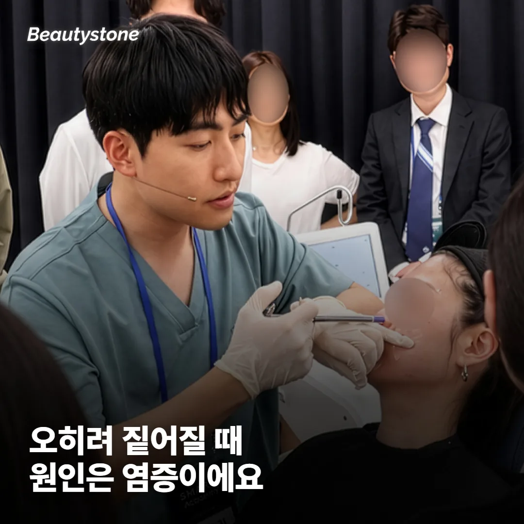 레이저를 받았는데 오히려 더 짙어졌어요, 왜 그럴까요?