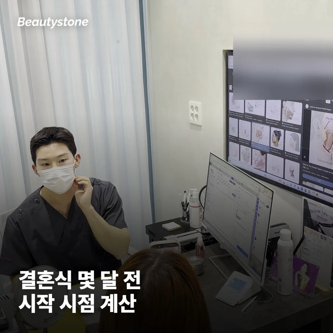 웨딩케어, 결혼식 몇 달 전에 시작하는 게 좋을까요?