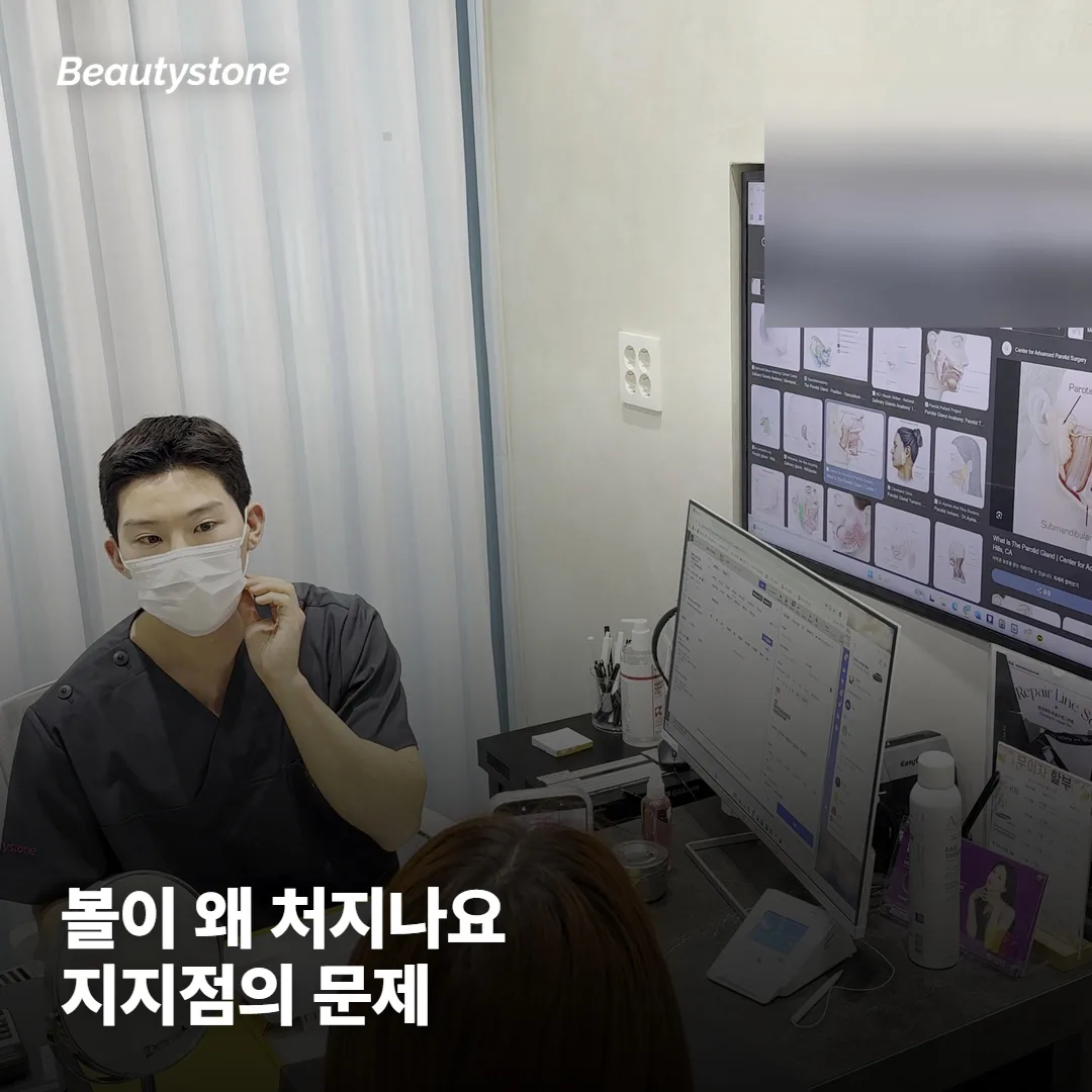 광대축소 후 볼이 왜 처지나요?
