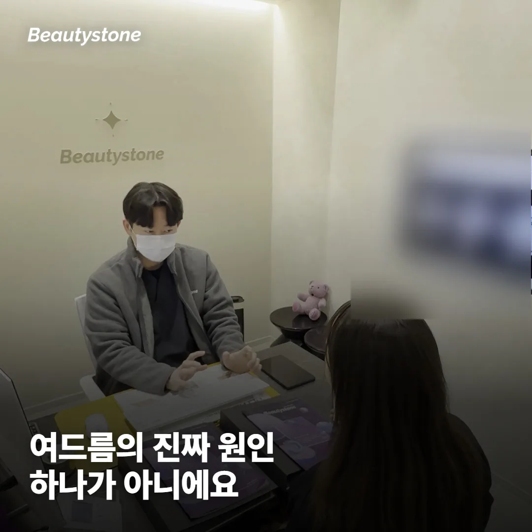 베개 커버가 여드름의 '진짜 원인'일까요?