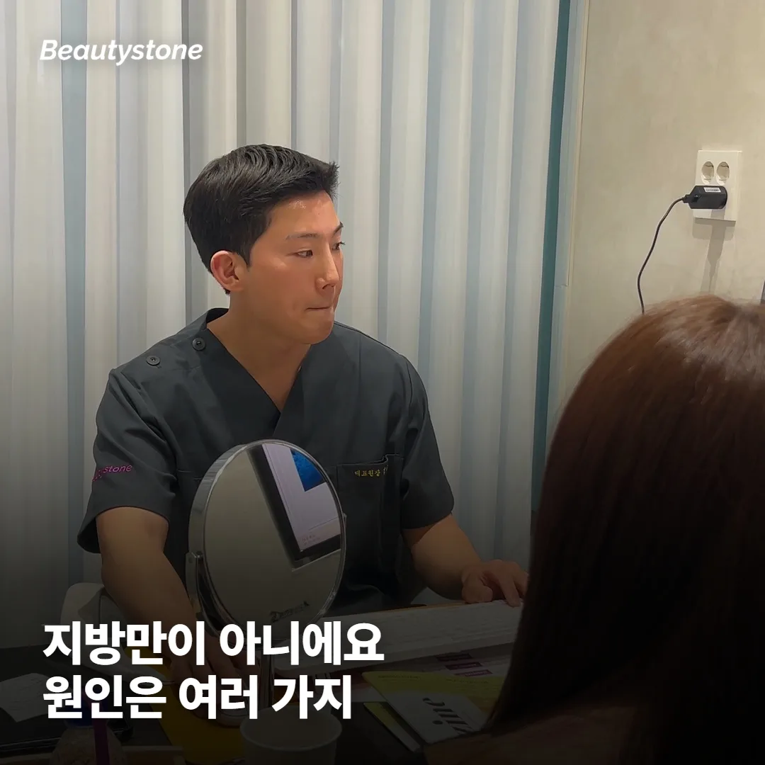 이중턱이 살 빼도 안 빠지는 이유가 뭘까요