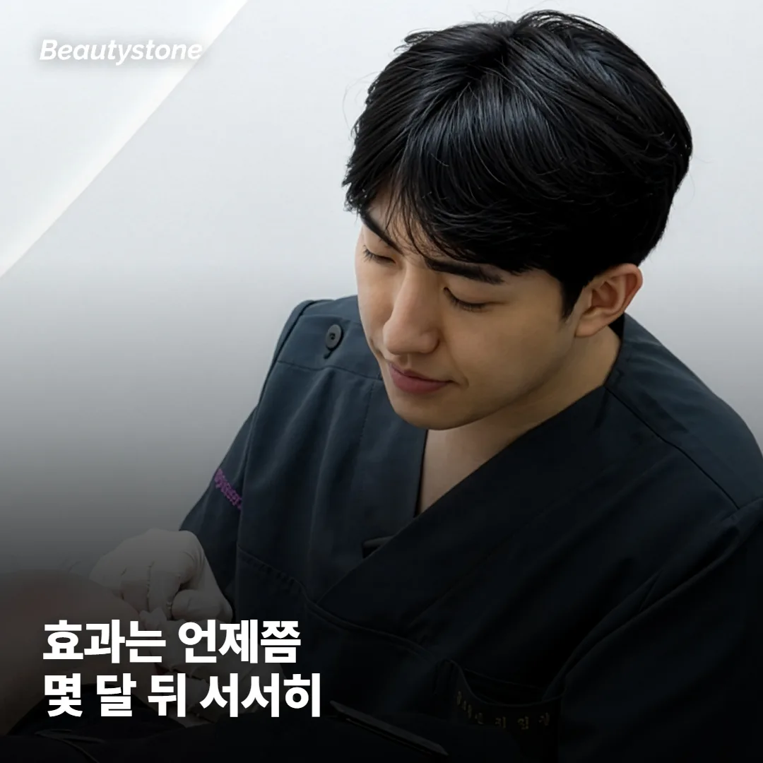 30대 써마지 효과는 언제, 얼마나 가나요