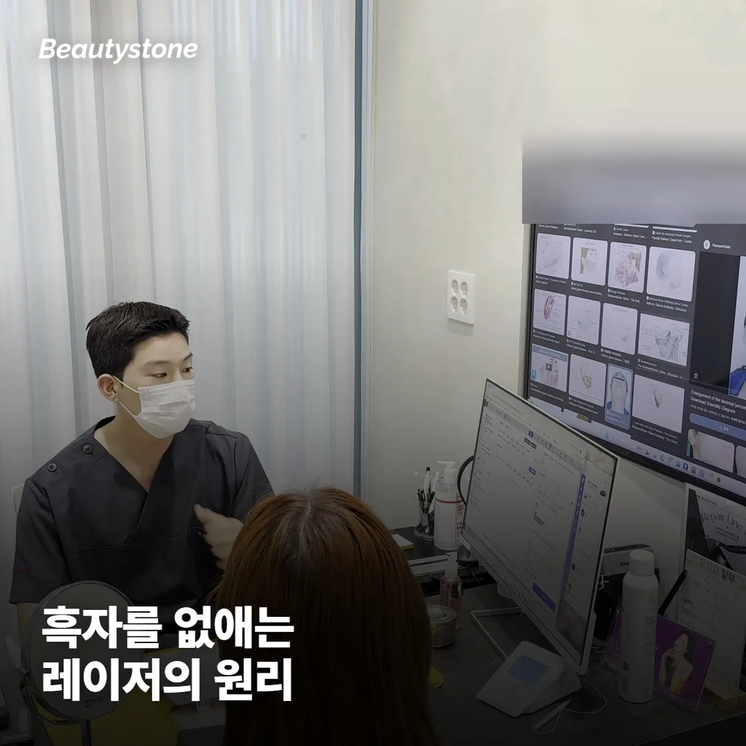 흑자 CO2 레이저는 어떻게 흑자를 없애나요?