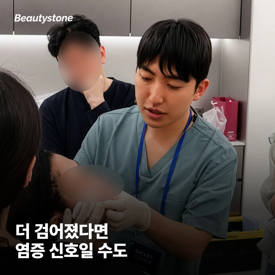 오히려 더 검어졌는데 왜 그럴까요?
