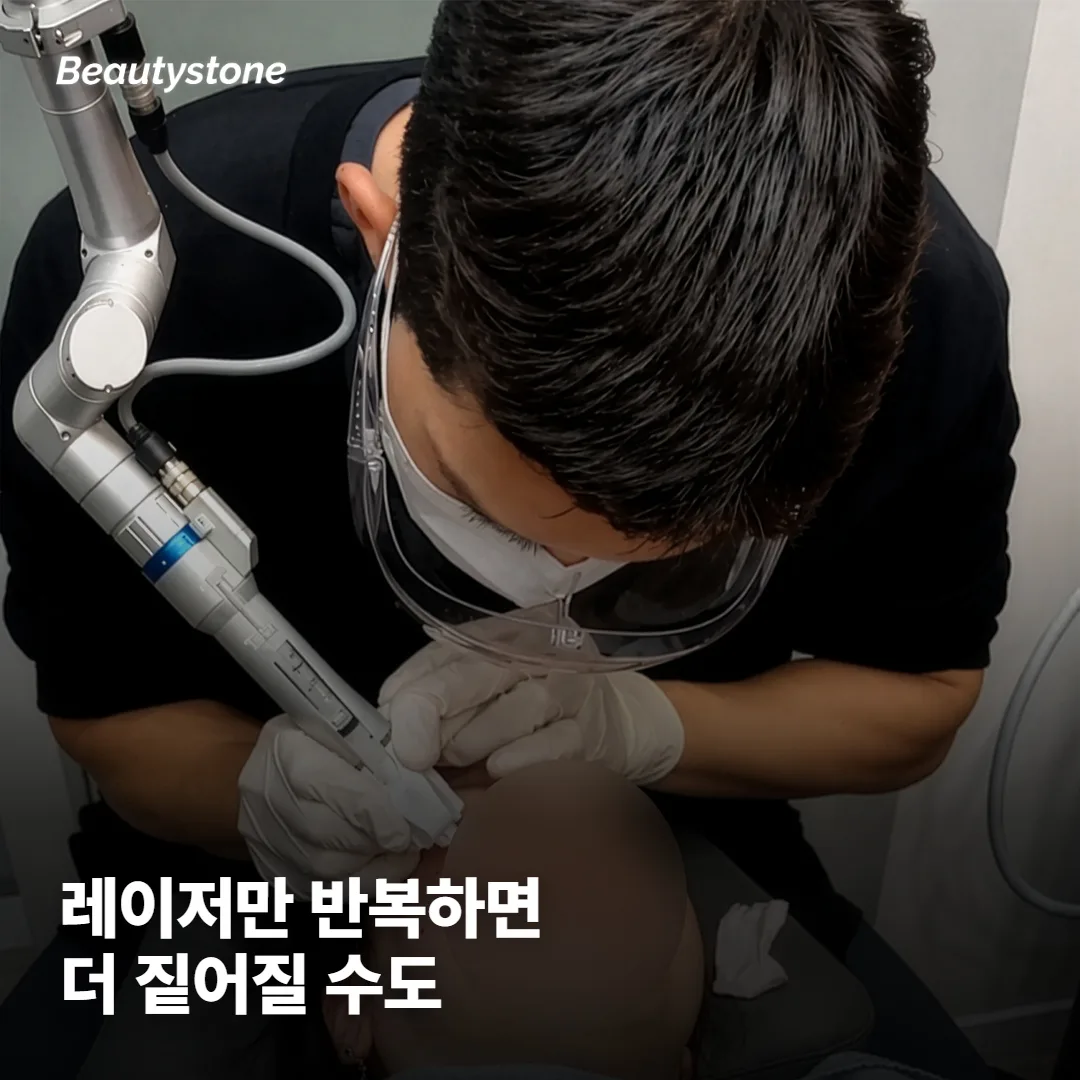 레이저를 더 받으면 기미가 빠질까요?