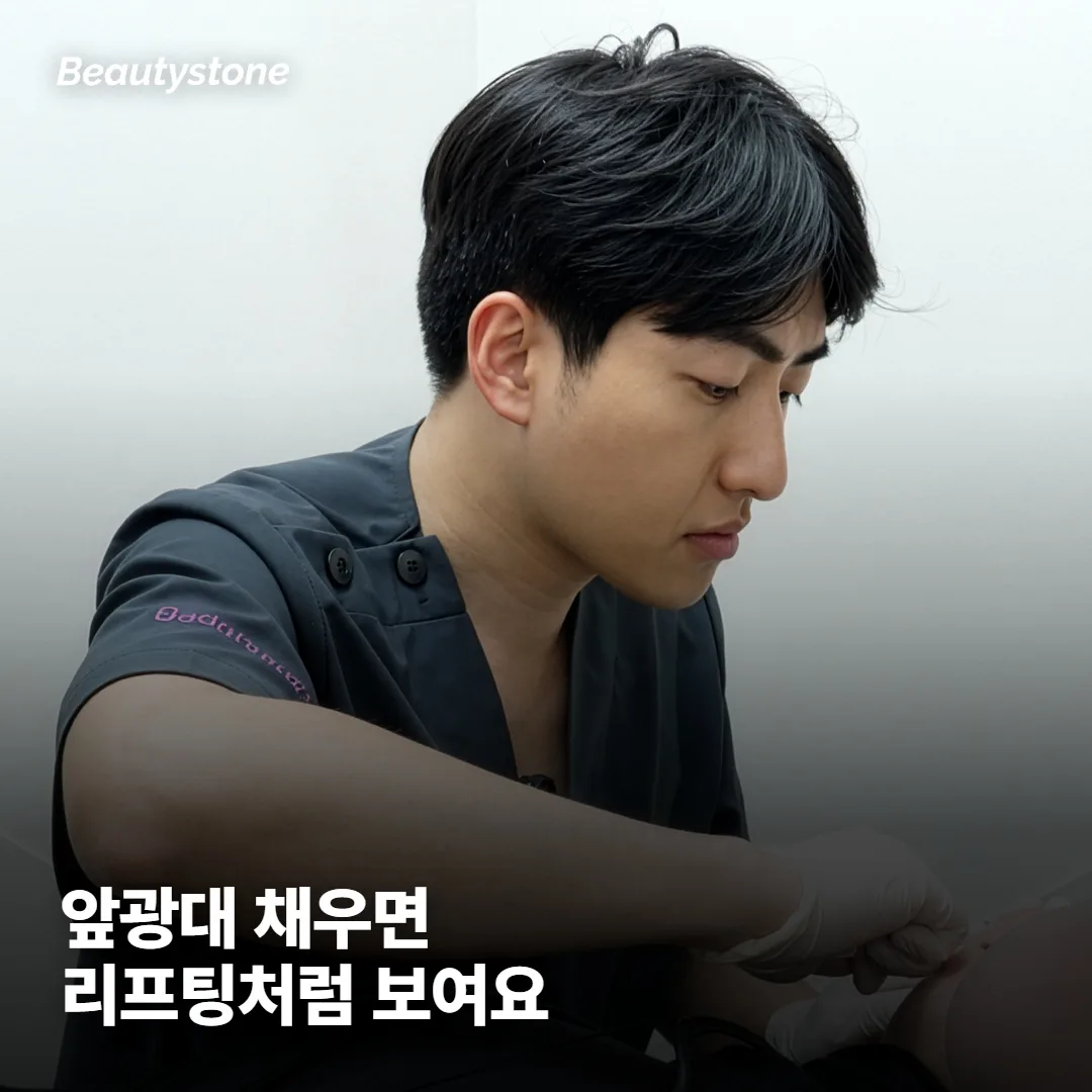 왜 광대에 채웠는데 리프팅처럼 보일까요