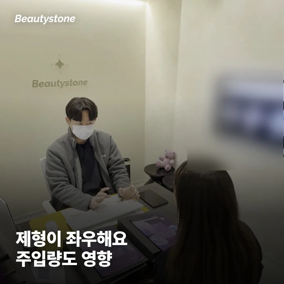 부위 말고 지속기간을 좌우하는 것들