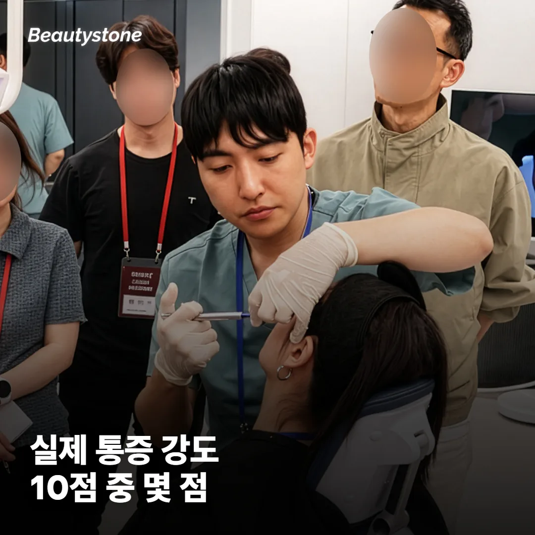 소프웨이브 통증, 실제로 어느 정도인가요?