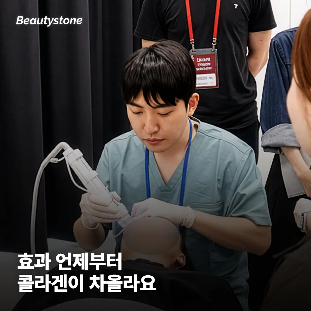 올리지오X 효과, 언제부터 보이고 뭐가 달라지나요?