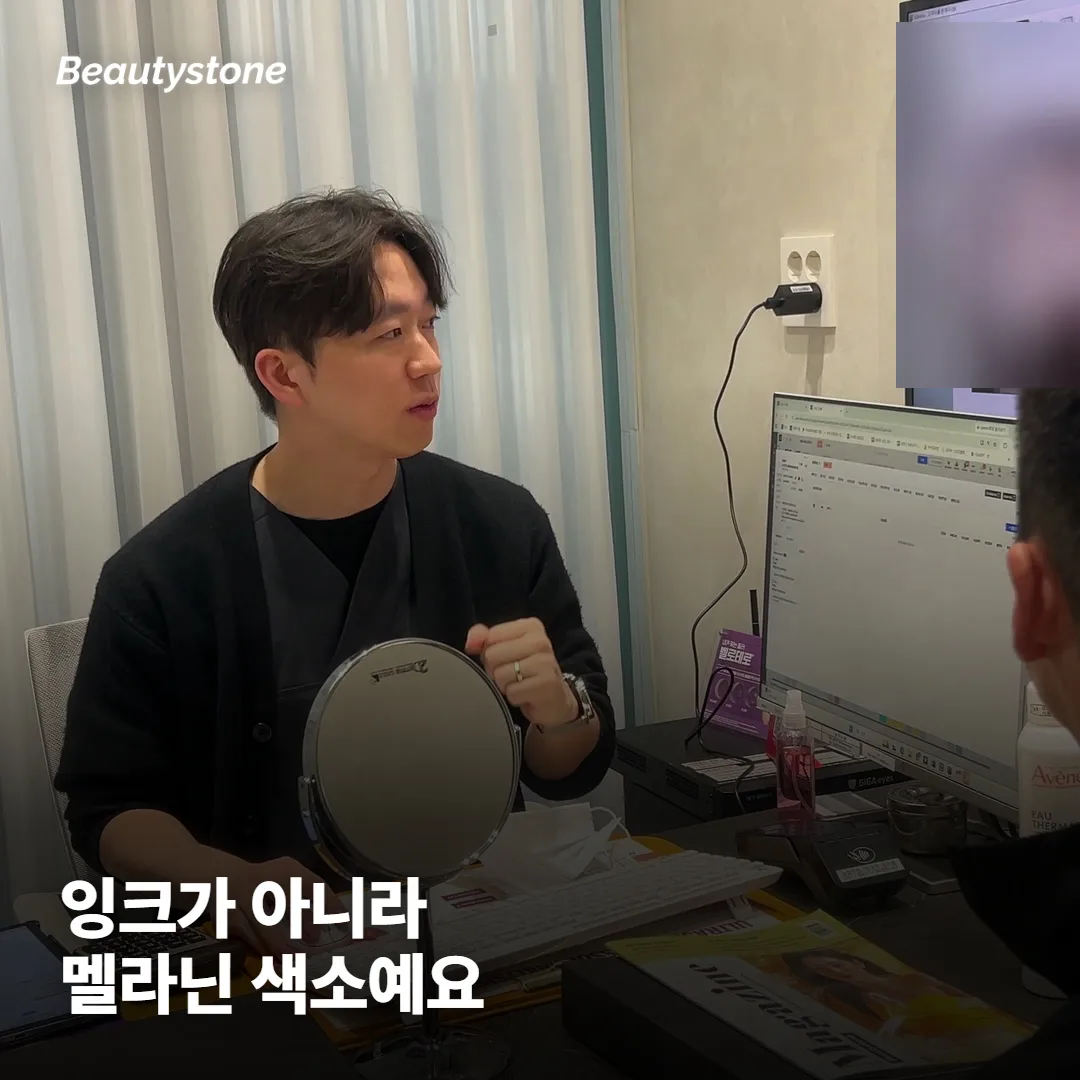 거뭇해진 자국, 잉크가 남은 게 아니라 멜라닌이 올라온 거예요