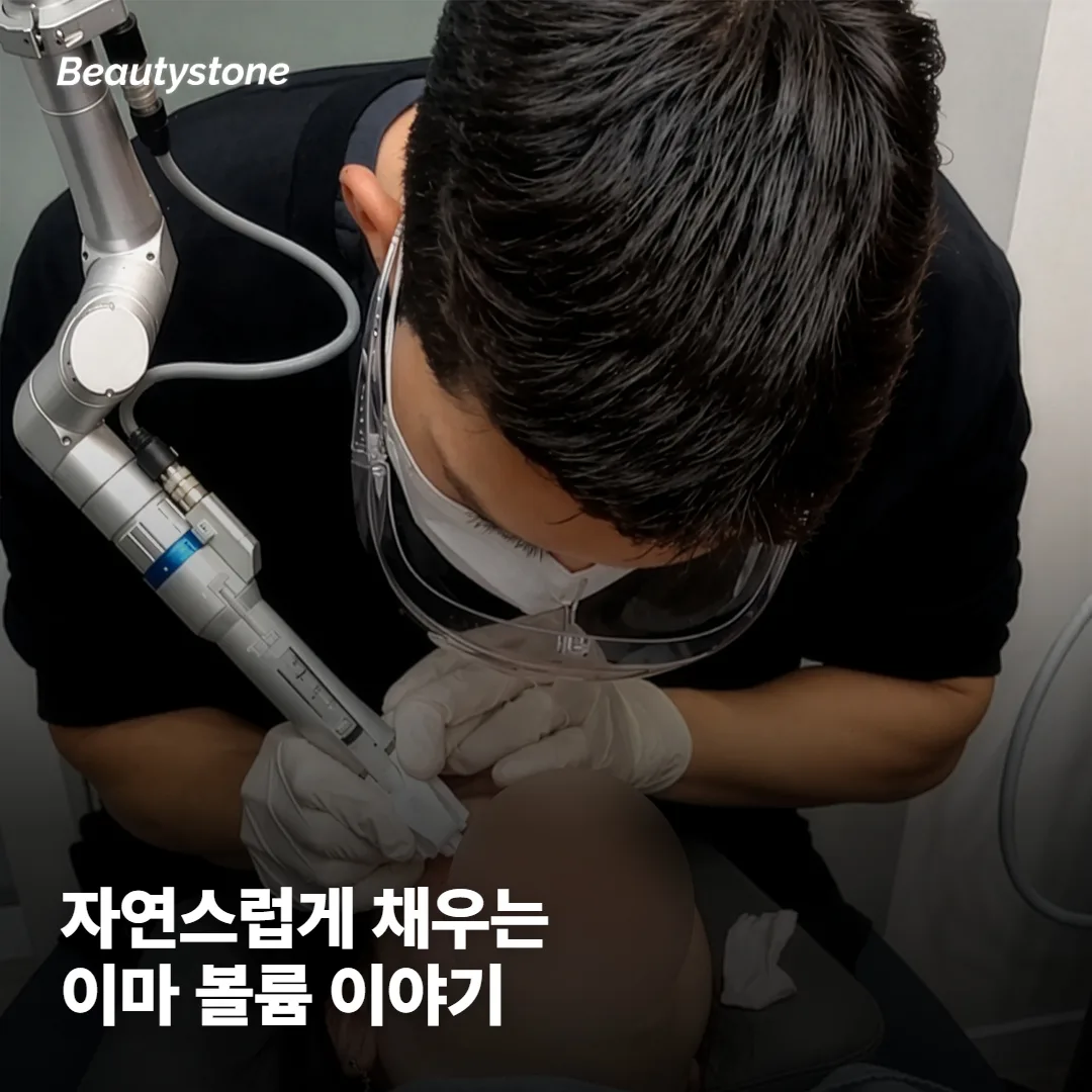 이마 필러, 실제로 얼마나 자연스럽게 채워질까요?