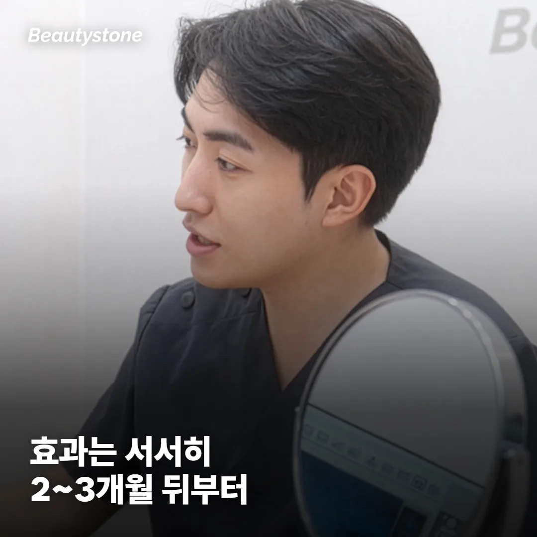 울쎄라 효과, 얼마나 오래 가나요?