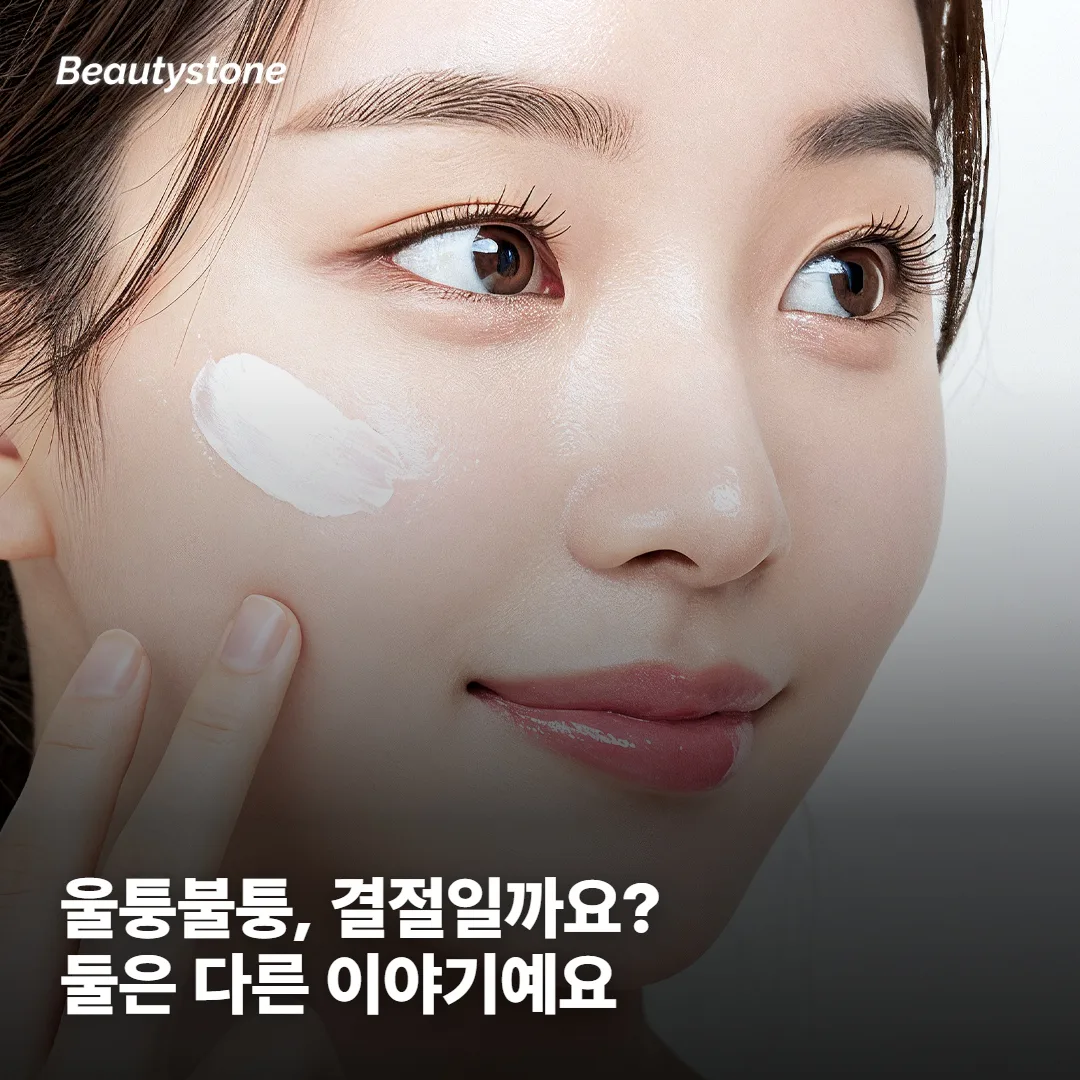 통증과 엠보싱, '셀르디엠 결절'은 어떻게 봐야 하나요?