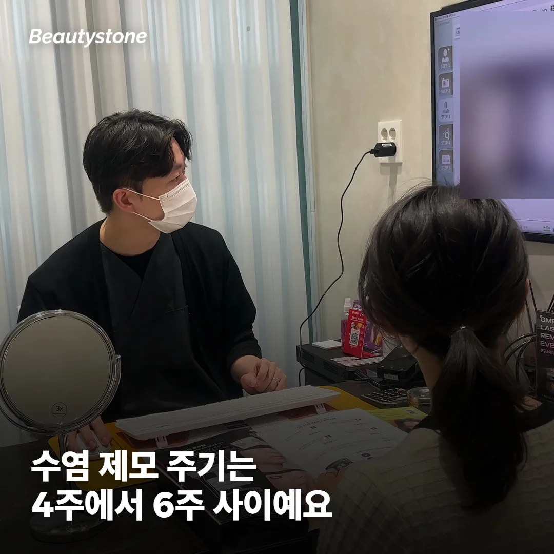 수염 제모 주기, 6주가 맞나요?